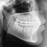 Radiologia Odontológica no Centro de Goiânia